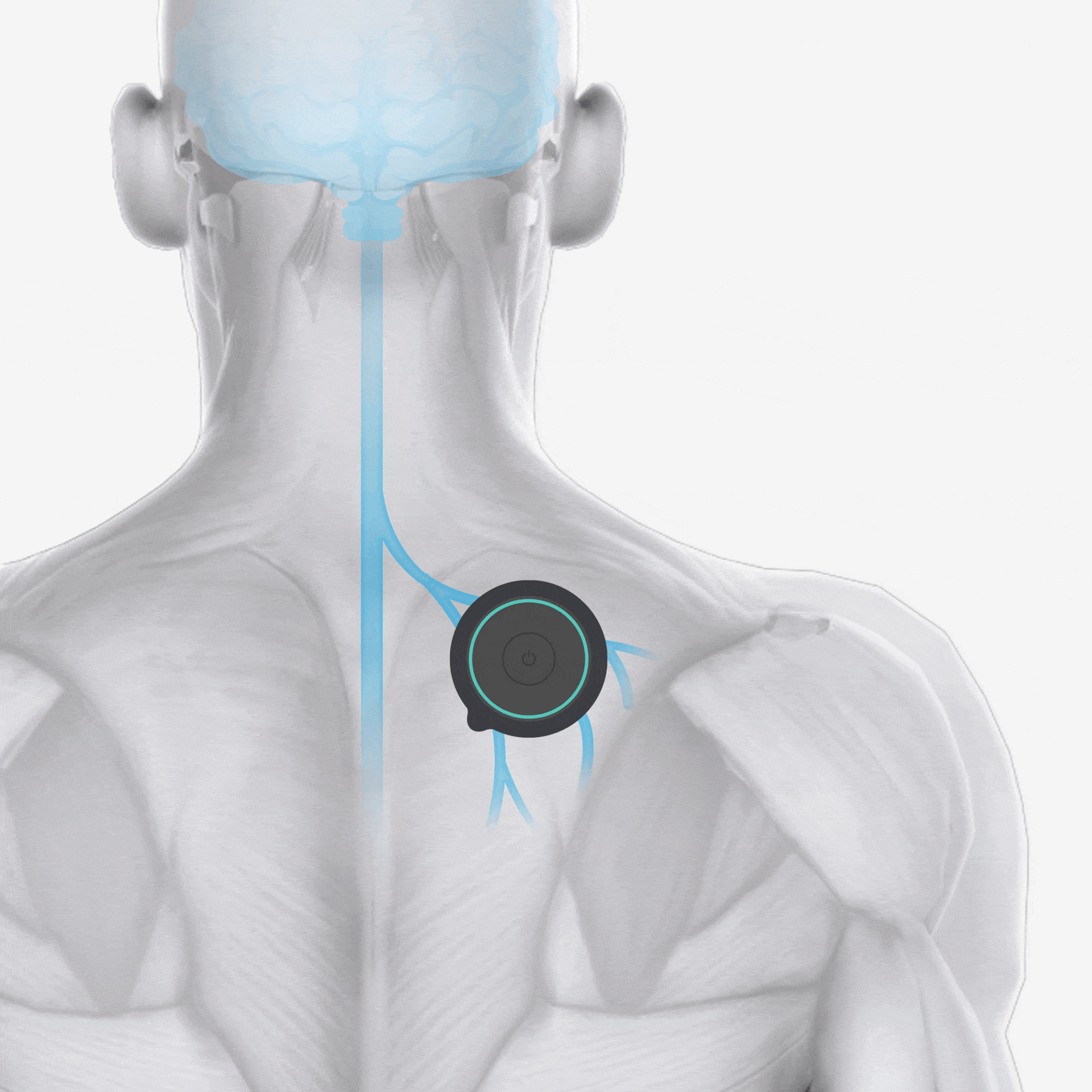 Uses transcutaneous electrical nerve stimulation (TENS) for delivering targeted pain relief